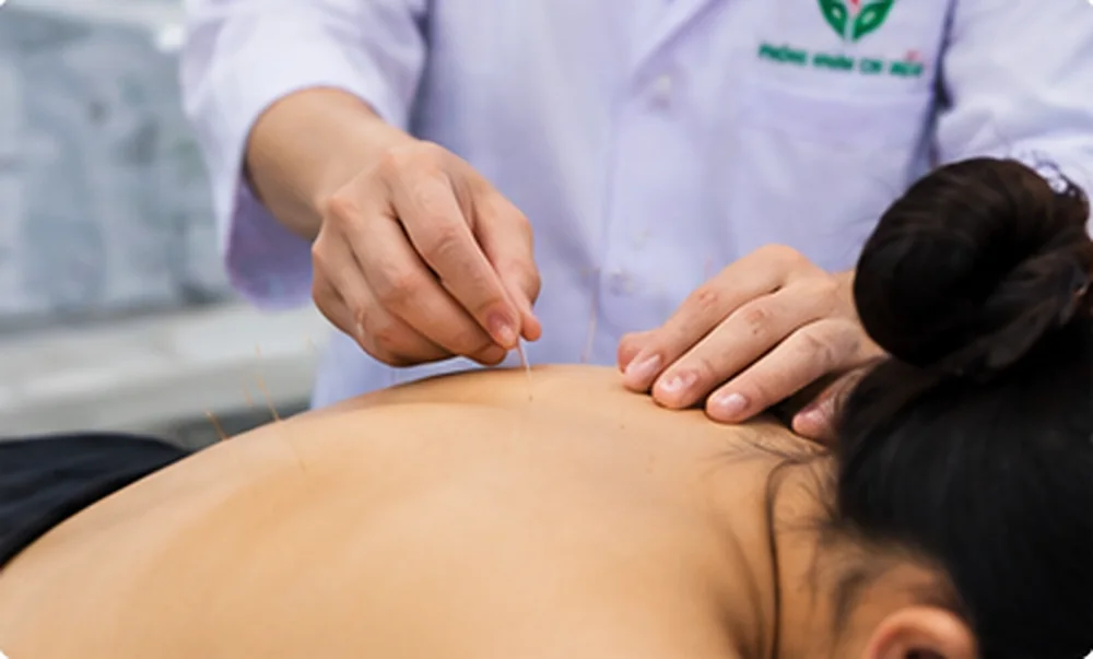 Châm cứu và bấm huyệt: những điều cần biết trước khi điều trị